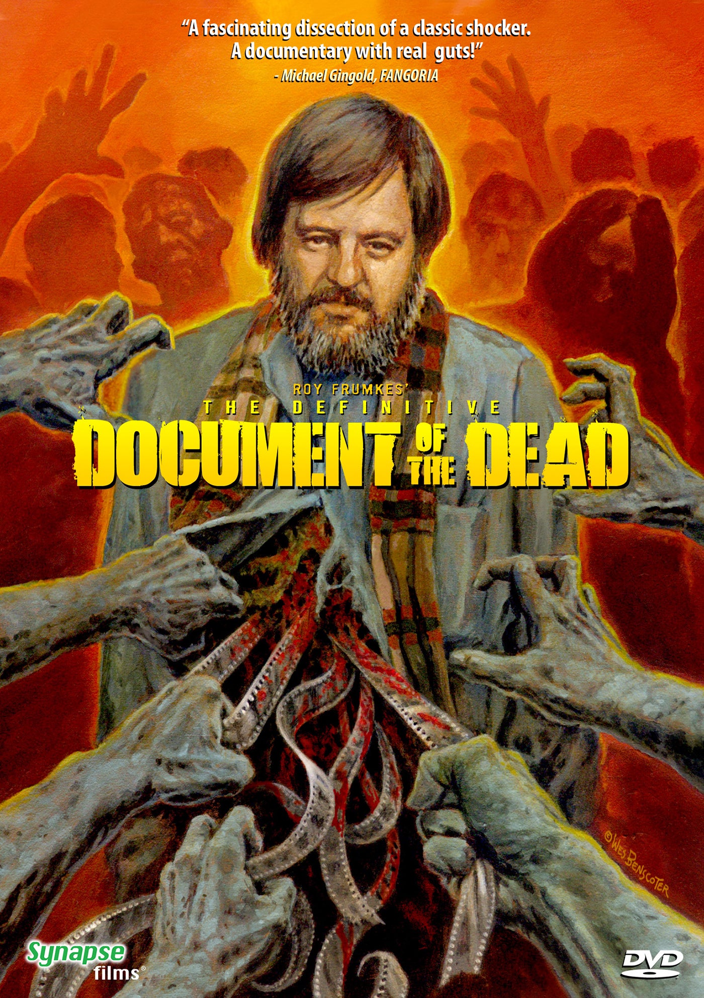 Definitive Document of the Dead, The [DVD] – Synapse Films